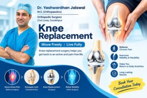 Knee Replacement