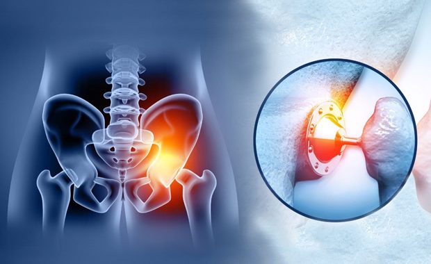 hip replacement surgery.jpg