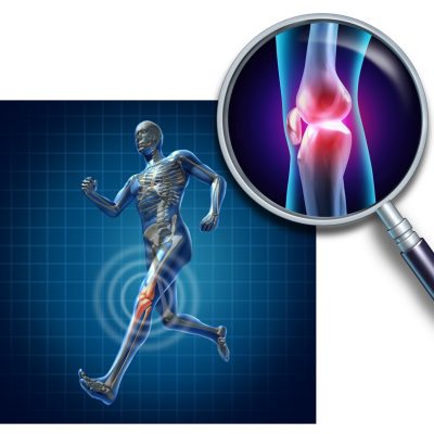 knee injury with a running athlete